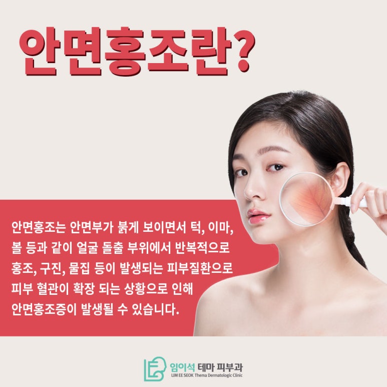Learn About Treatments to Relieve Rosacea Symptoms image 3