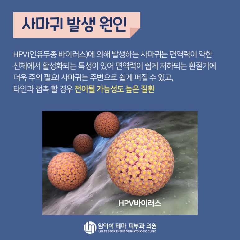 Wart Causes and Treatment! Explained by Im Eui-seok Dermatology image 3