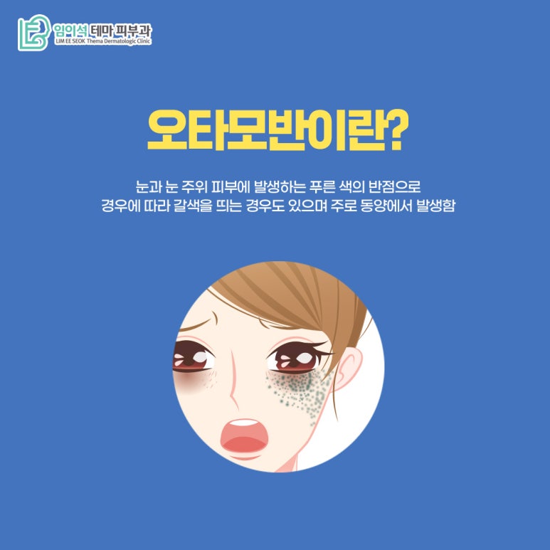 임이석피부과 오타모반, 난치성 색소질환의 발생 원인과 치료법 관련 이미지 3