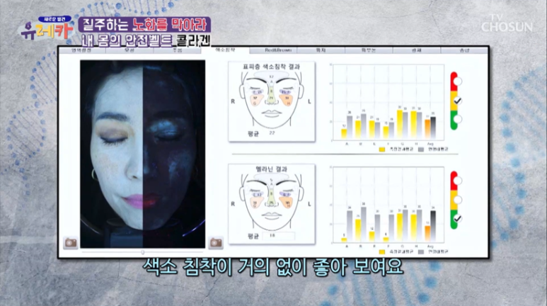 강남피부과전문의 임이석원장, "동안의 주인공 과연 피부나이 측정 결과는?"- TV CHOSUN [새로운 발견 유레카] 출연 관련 이미지 3
