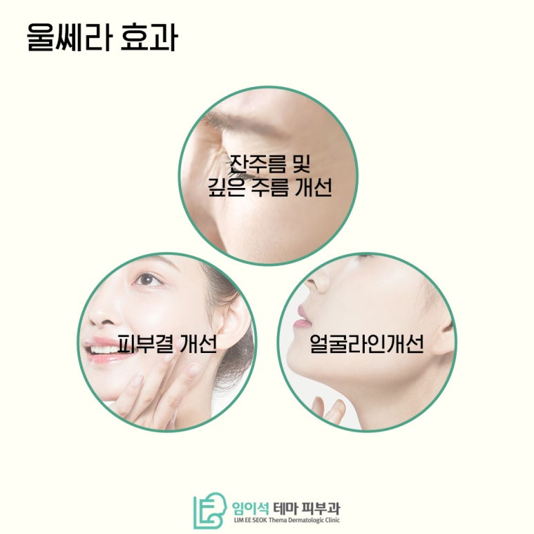 임이석테마피부과에서 알려드리는 강력한 리프팅 효과 "울쎄라" 관련 이미지 4
