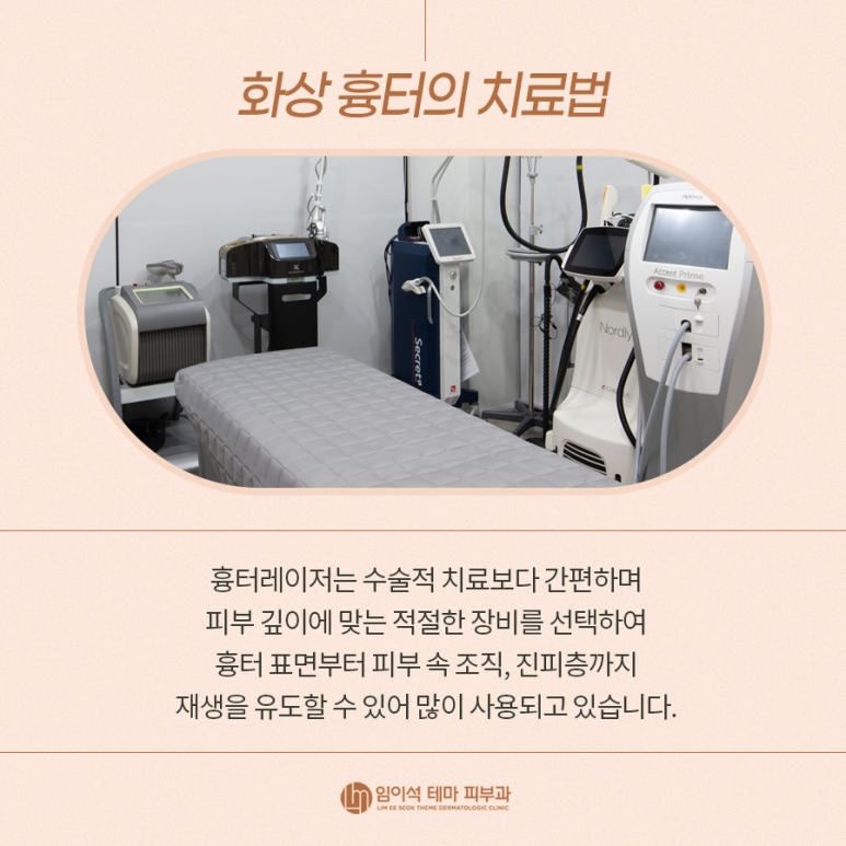 스트레스의 원인인 화상 흉터의 종류와 치료방법 관련 이미지 5