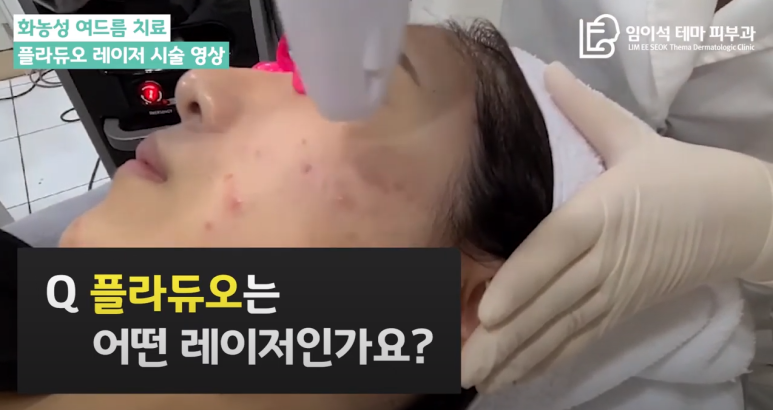 [Imiseok Theme Dermatology YouTube Channel] Treatment of Pustular Acne image 1