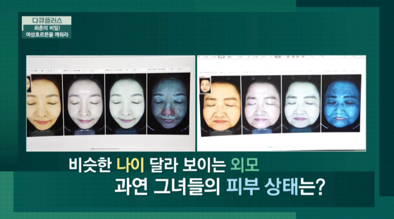 피부과전문의 임이석 관련 이미지 1