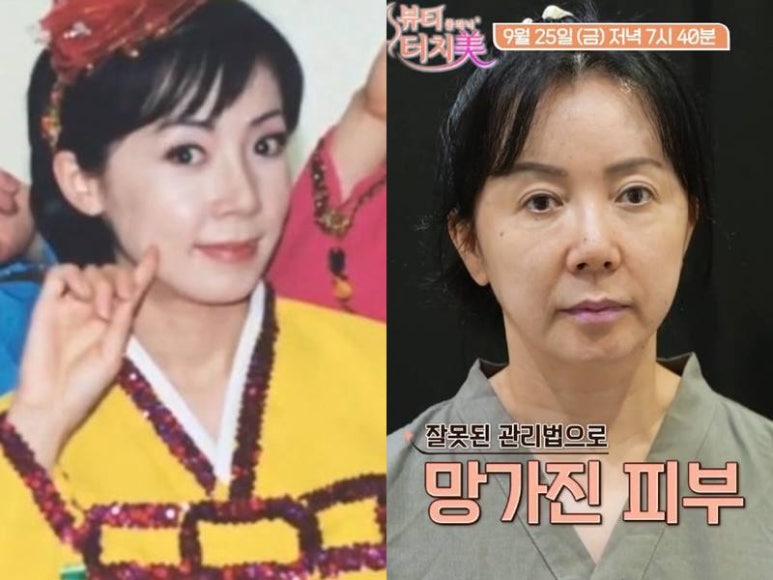 알콜스왑으로 얼굴 닦는 습관, 피부에 괜찮을까? ｜임이석테마피부과 임이석 대표원장 (채널A 뷰티클리닉 터치미 10화 김혜영편) 관련 이미지 7