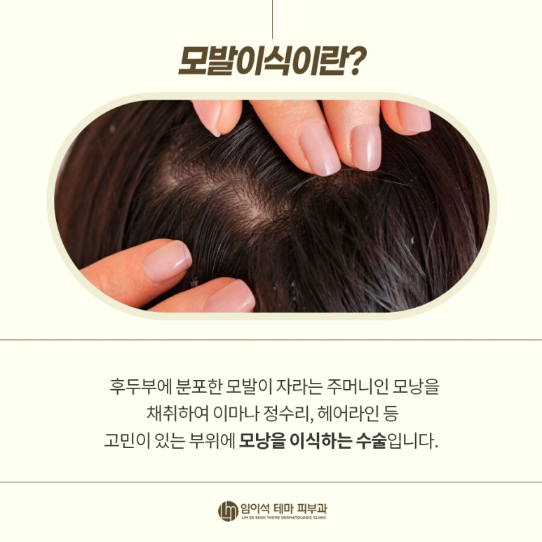 Hair Transplant Incision vs. Non-Incision: Learning the Benefits and Differences image 3