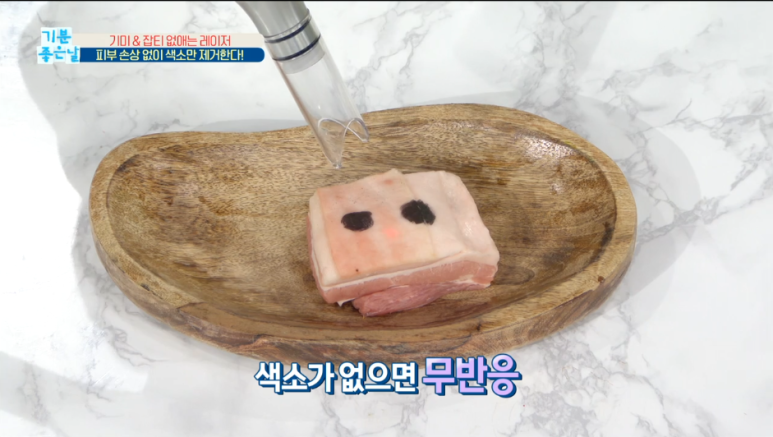 임이석테마피부과 기미를 없애는 법, 기미 레이저 전후 공개! MBC 기분좋은날 출연 관련 이미지 12