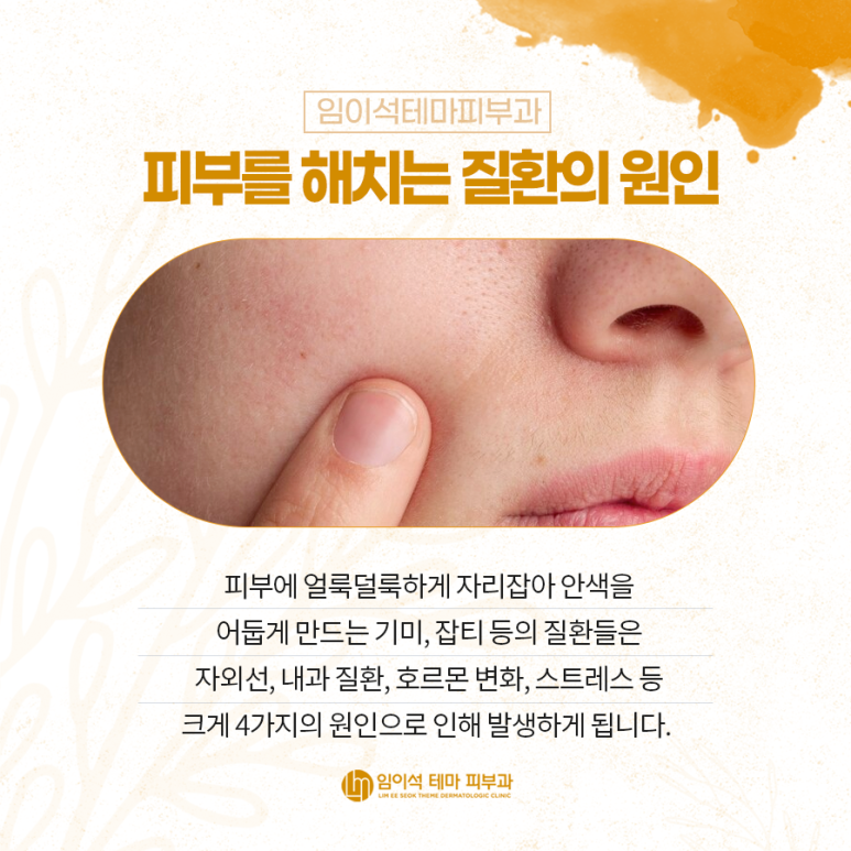 환한 얼굴로 만드는 레이저 베스트3 관련 이미지 3