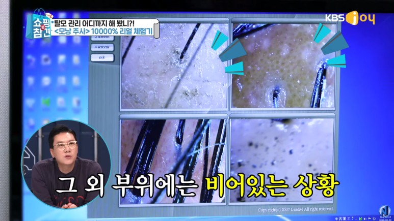 KBS Joy Shopping’s Pointers <A Full Breakdown of Anti-Hair-Loss Items> image 3