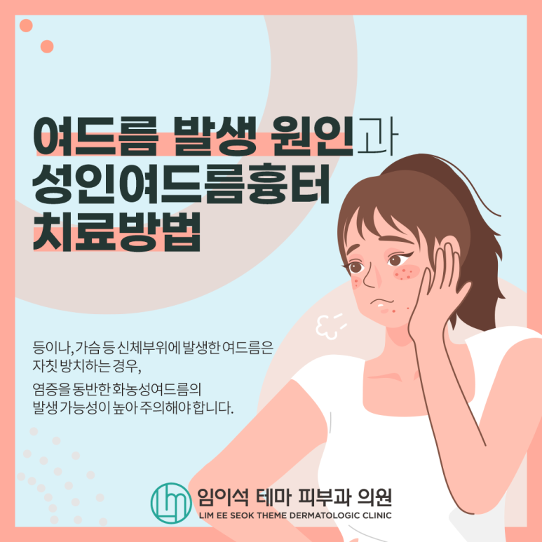 Causes of Acne and Treatment Methods for Adult Acne Scars image 2