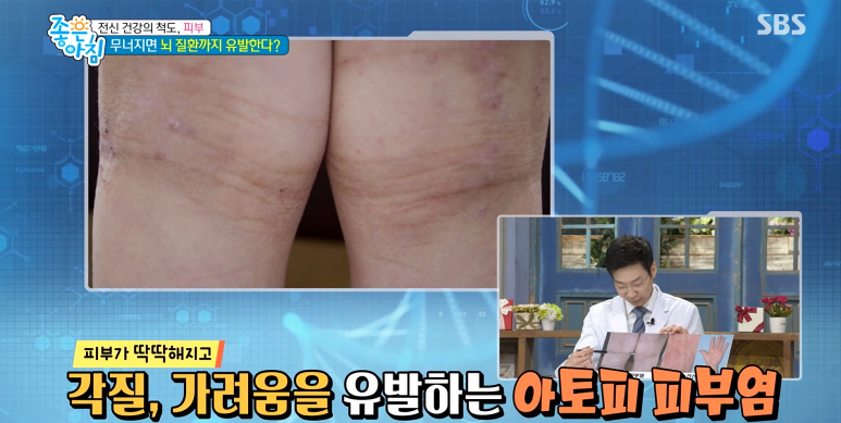 임이석원장 "건강한 피부세포가 전신을 지킨다!" SBS 좋은아침 출연 관련 이미지 12