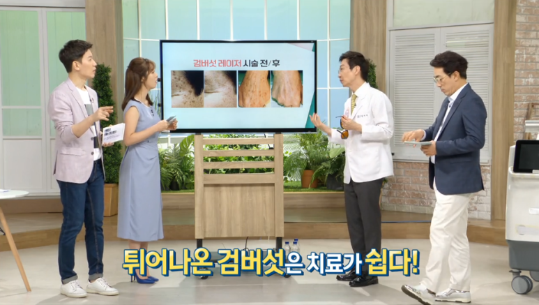 임이석테마피부과 기미를 없애는 법, 기미 레이저 전후 공개! MBC 기분좋은날 출연 관련 이미지 22