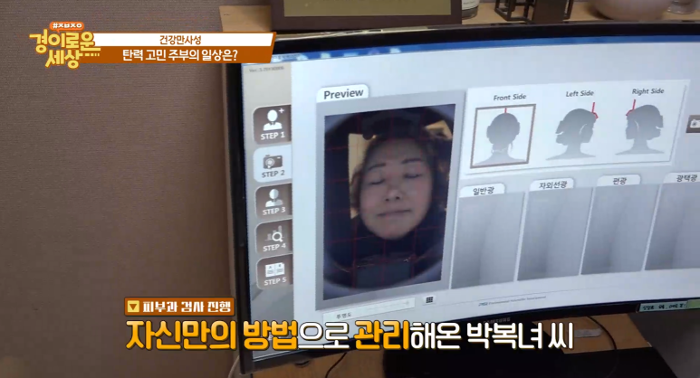 Director Im E-seok: “Elasticity That Protects Overall Health! Elastin” Appearance on OBS Amazing World image 6