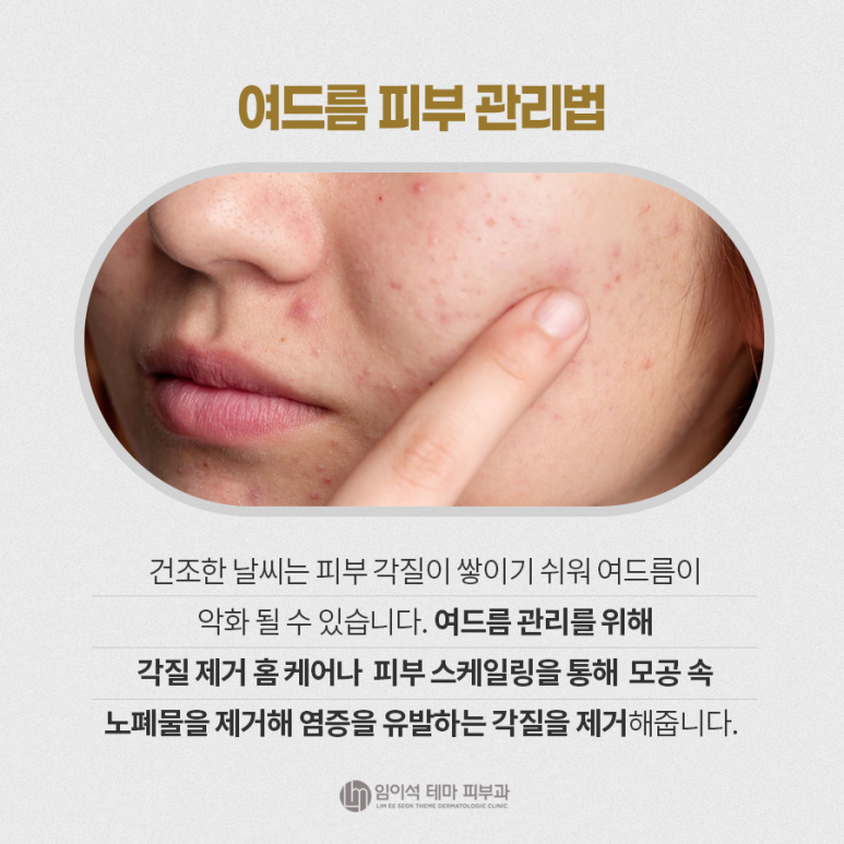 겨울철 피부타입별 피부관리 방법 관련 이미지 3
