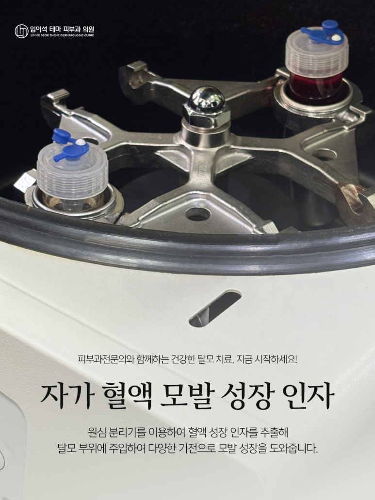 Sinsa Station Hair Loss Treatment, the Scalp Is Skin Too! Treatment Should Be by a Dermatology Specialist image 2
