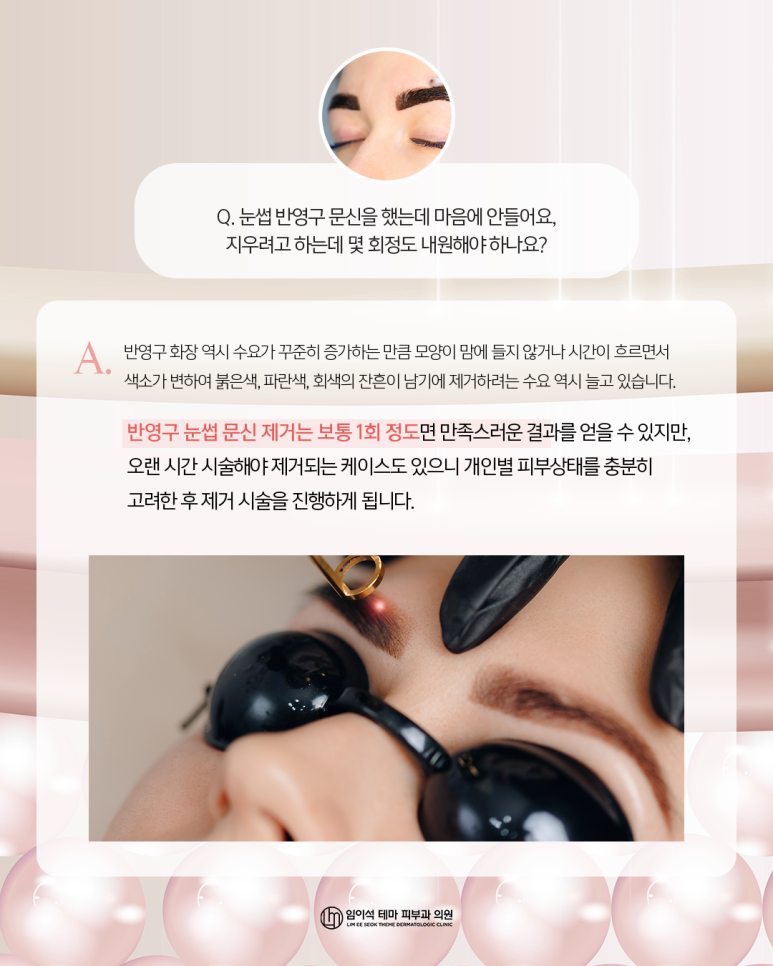 신사역피부과추천, 유행지난 반영구&middot;문신제거 방법은? 관련 이미지 4