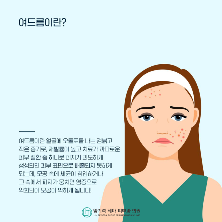 피지선을 개선하는 효과적인 여드름 치료 관련 이미지 3