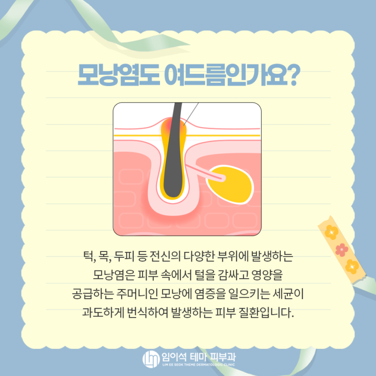 여드름의 종류, 원인, 치료, 흉터 관리법 관련 이미지 5