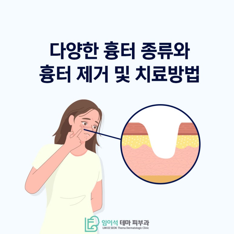 레이저를 활용한 다양한 흉터 제거 방법 관련 이미지 2