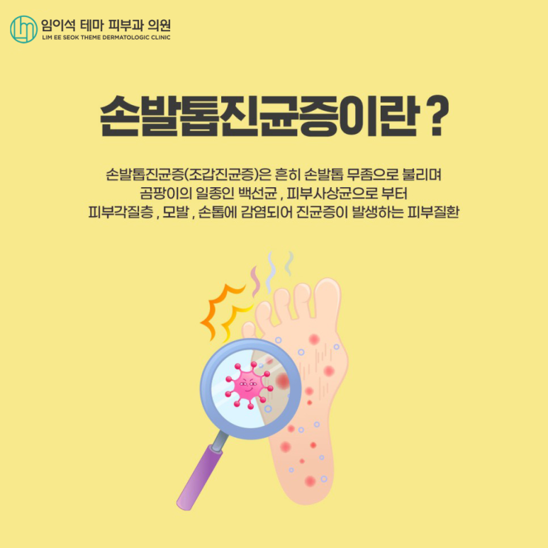 Nail Fungus: What Is the Most Effective Treatment? image 3