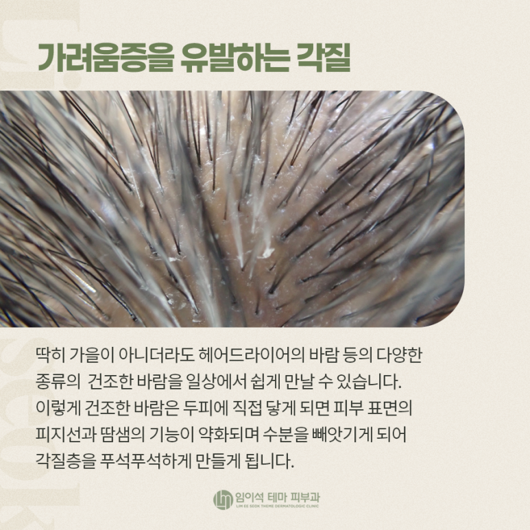 여성탈모, 각질관리가 필요한 이유 관련 이미지 3