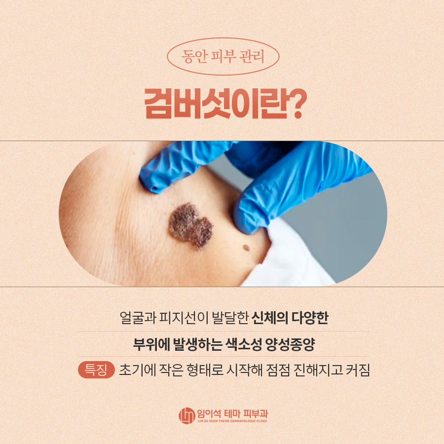 Treatment for Age Spots That Rewinds Time image 3