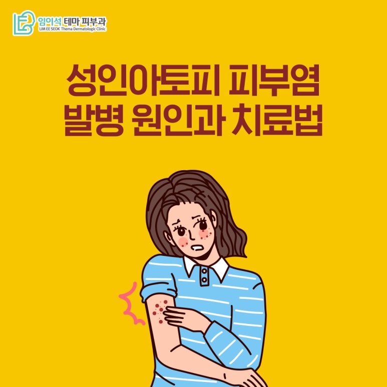 임이석피부과 성인아토피 피부염의 발병 원인과 치료법 관련 이미지 2