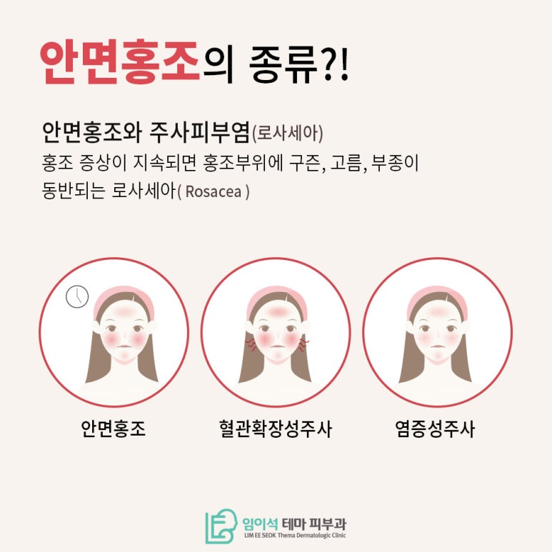 Learn About Treatments to Relieve Rosacea Symptoms image 4