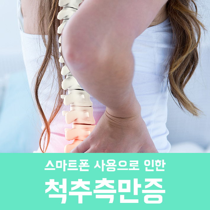 Smartphone-Related Carpal Tunnel Syndrome, Scoliosis, and Turtle Neck Pain image 3