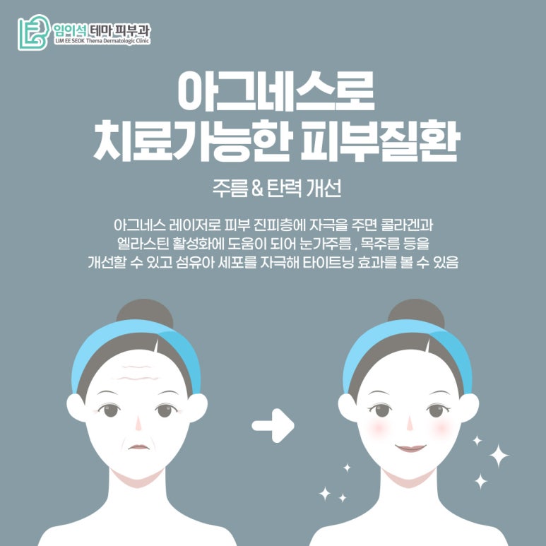 신사피부과 임이석피부과의 아그네스 레이저 치료법 관련 이미지 6