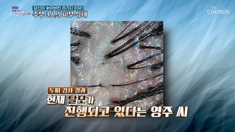 임이석 원장 "당신이 늙어버린 N가지 이유" TV조선 건강다큐 출연 관련 이미지 5