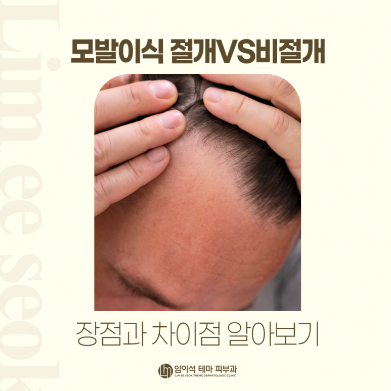 Hair Transplant Incision vs. Non-Incision: Learning the Benefits and Differences image 2