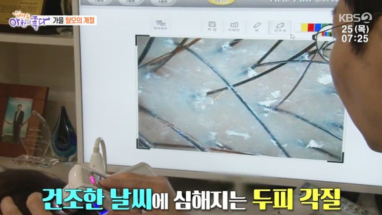 KBS 2TV 생방송 아침이 좋다 관련 이미지 4