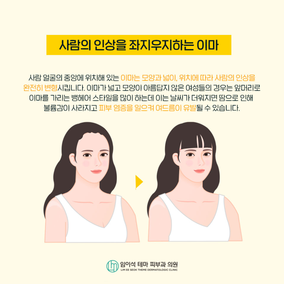 헤어라인 교정 방법은 무엇이 있을까요? 관련 이미지 3