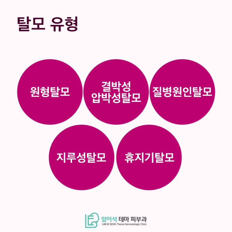 Effective Treatment Methods According to the Causes and Types of Female Hair Loss image 4