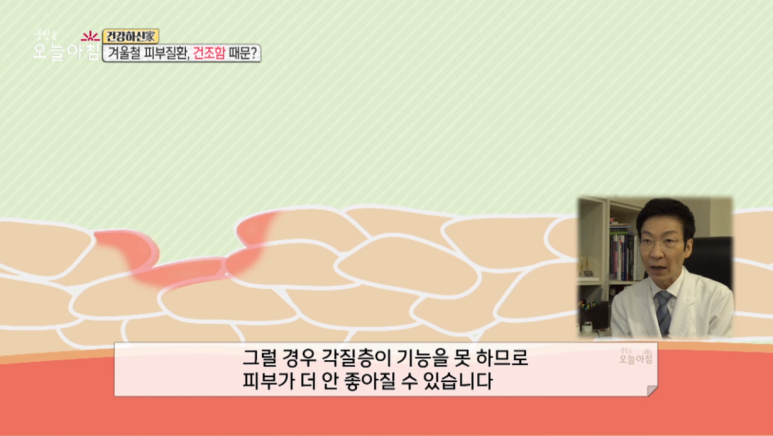 Director Im E-seok: “Winter Skin Conditions, Because of Dryness?” Appearances on MBC Live Morning Today image 6