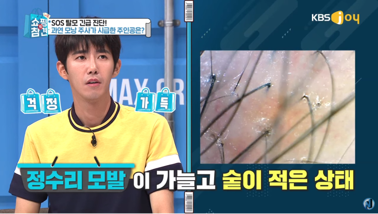 KBS Joy Shopping’s Pointers <A Full Breakdown of Anti-Hair-Loss Items> image 16