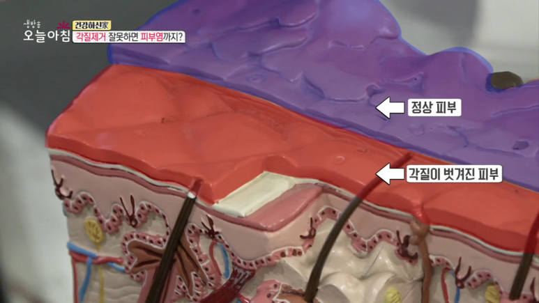 Director Im E-seok Appears on MBC's Live Morning Today, "Are You Healthy?" image 5