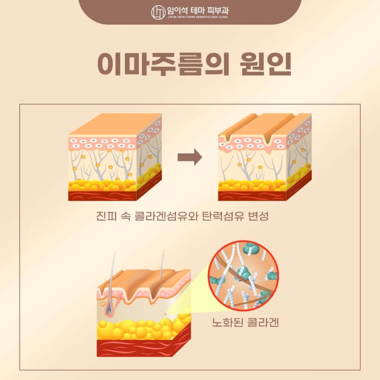 If You’re 고민ing About a Forehead Wrinkle Lifting Treatment at a Sinsa Station Dermatology Clinic image 2