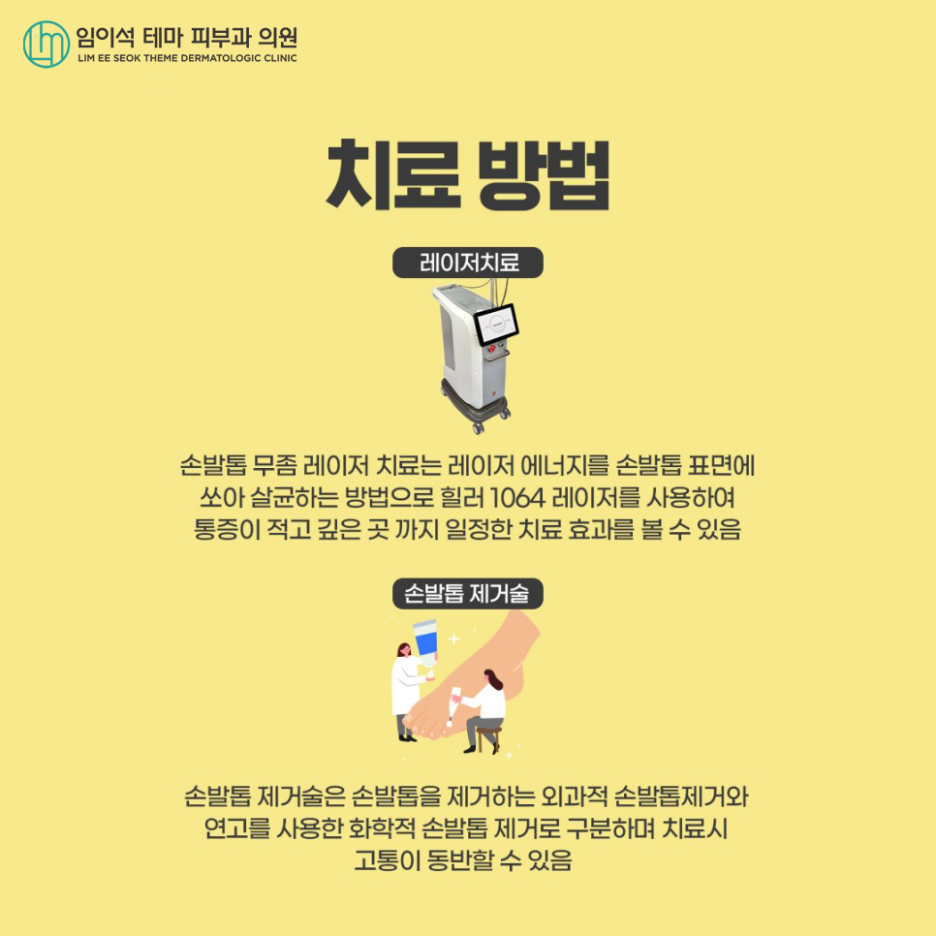 손발톱진균증, 효과적인 치료법은? 관련 이미지 9