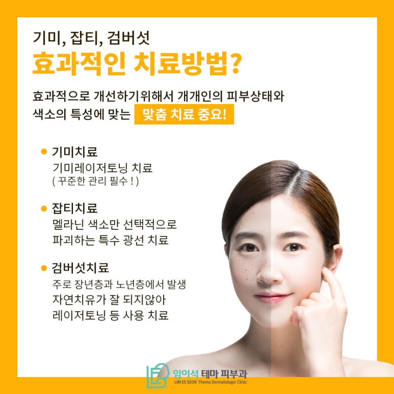 기미잡티, 색소침착 개선을 위한 레이저토닝 치료법 관련 이미지 5