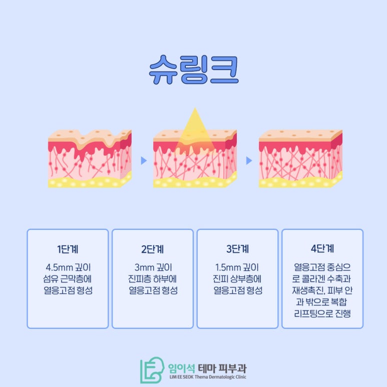 임이석테마피부과에서 알려드리는 동안 레이저 시술, 슈링크 관련 이미지 4