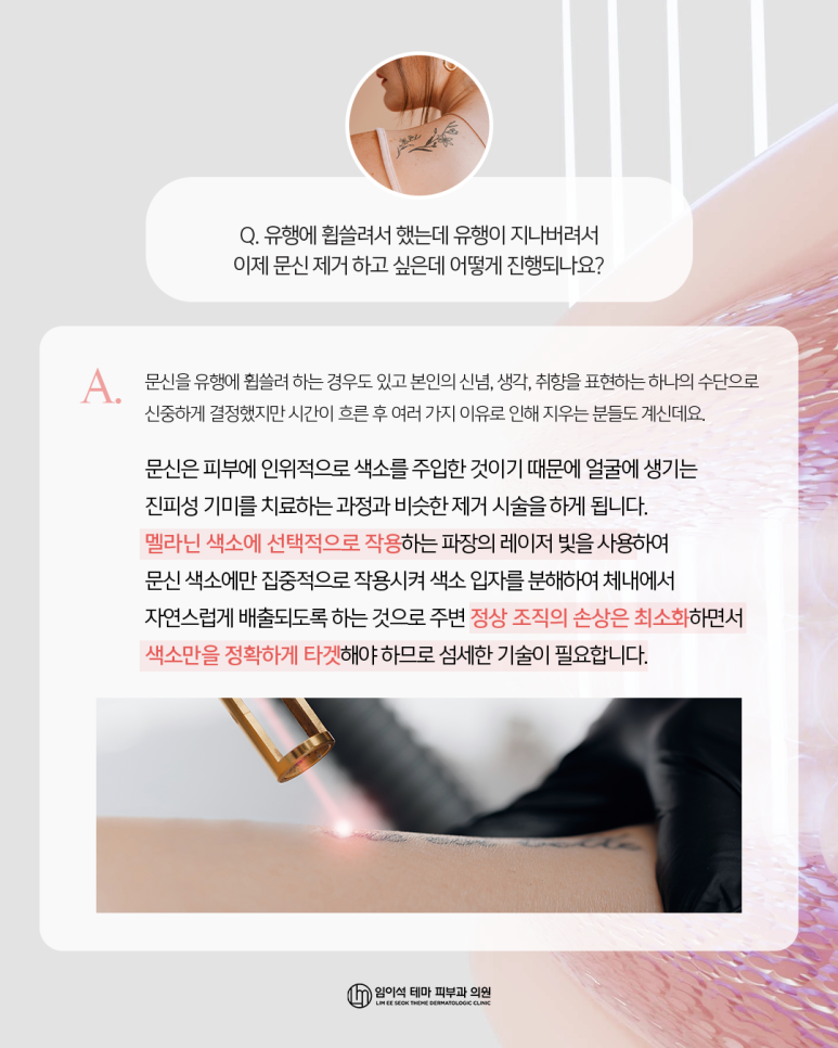 신사역피부과추천, 유행지난 반영구&middot;문신제거 방법은? 관련 이미지 2