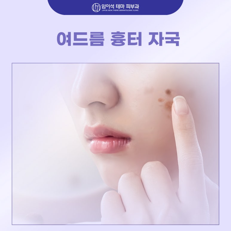 신사동 임이석테마피부과, 여드름 흉터 자국 레이저치료 효과 높이는 법 관련 이미지 2