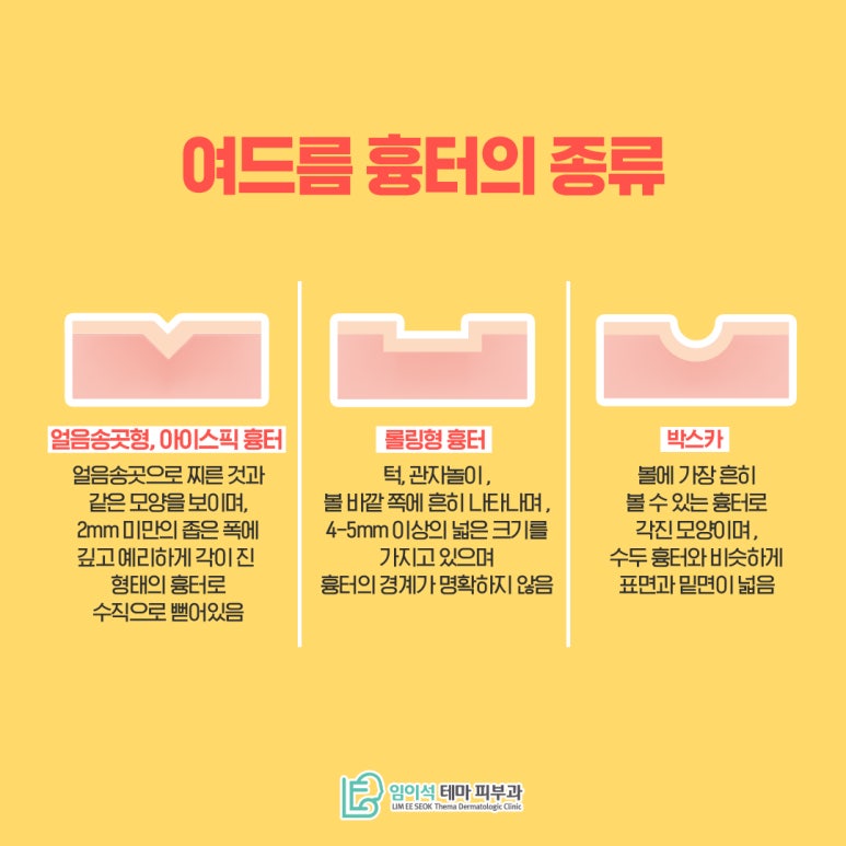 피부에 울퉁불퉁하게 생기는 여드름흉터 치료방법 관련 이미지 3