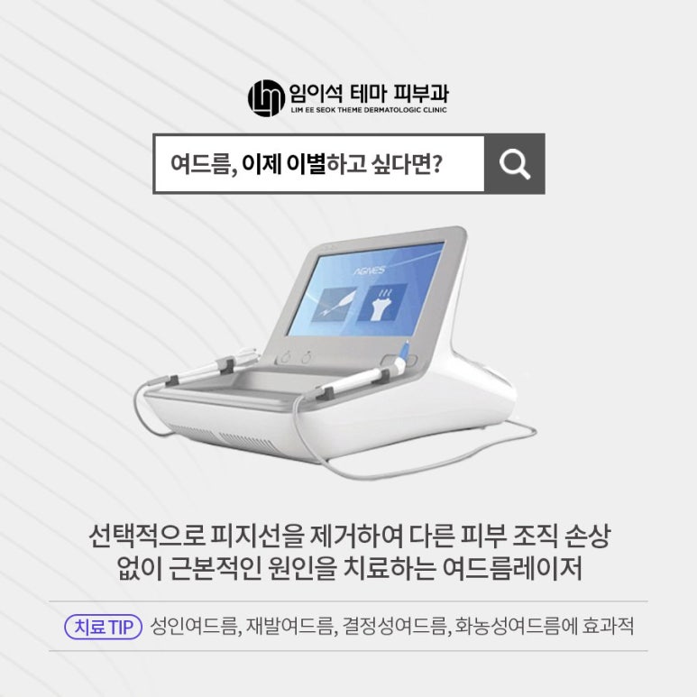 성인여드름, 화농성 여드름치료에 탁월한 아그네스 레이저 관련 이미지 2
