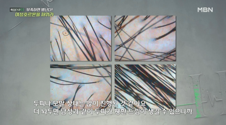 임이석테마피부과 임이석원장, MBN 특집다큐H 방송출연 관련 이미지 3