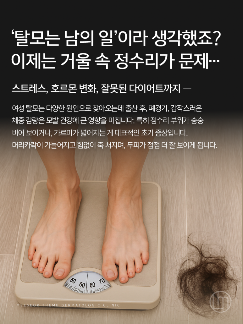 [여성탈모치료] 다이어트했더니 머리카락까지 같이 빠진 리얼 허거덩거덩스한 상황..! 관련 이미지 2