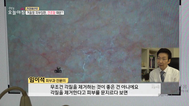 Director Im E-seok: “Winter Skin Conditions, Because of Dryness?” Appearances on MBC Live Morning Today image 5