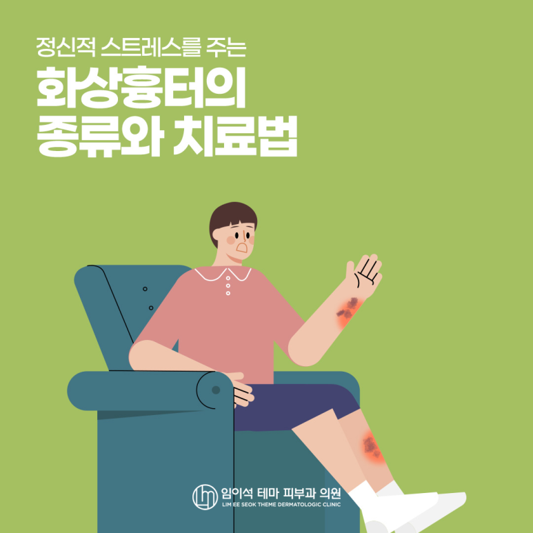 정신적 스트레스를 주는 화상흉터의 종류와 치료법 관련 이미지 2